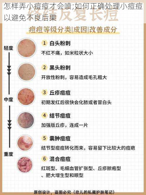 怎样弄小痘痘才会喷;如何正确处理小痘痘以避免不良后果