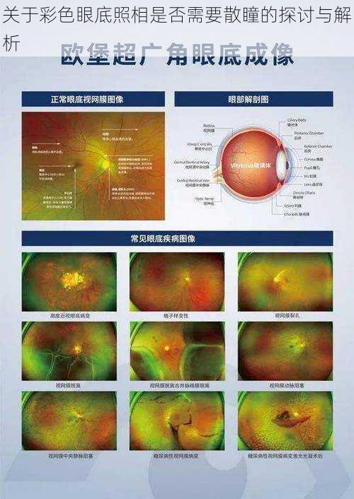 关于彩色眼底照相是否需要散瞳的探讨与解析